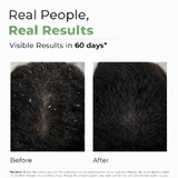 Anti-Dandruff Oil