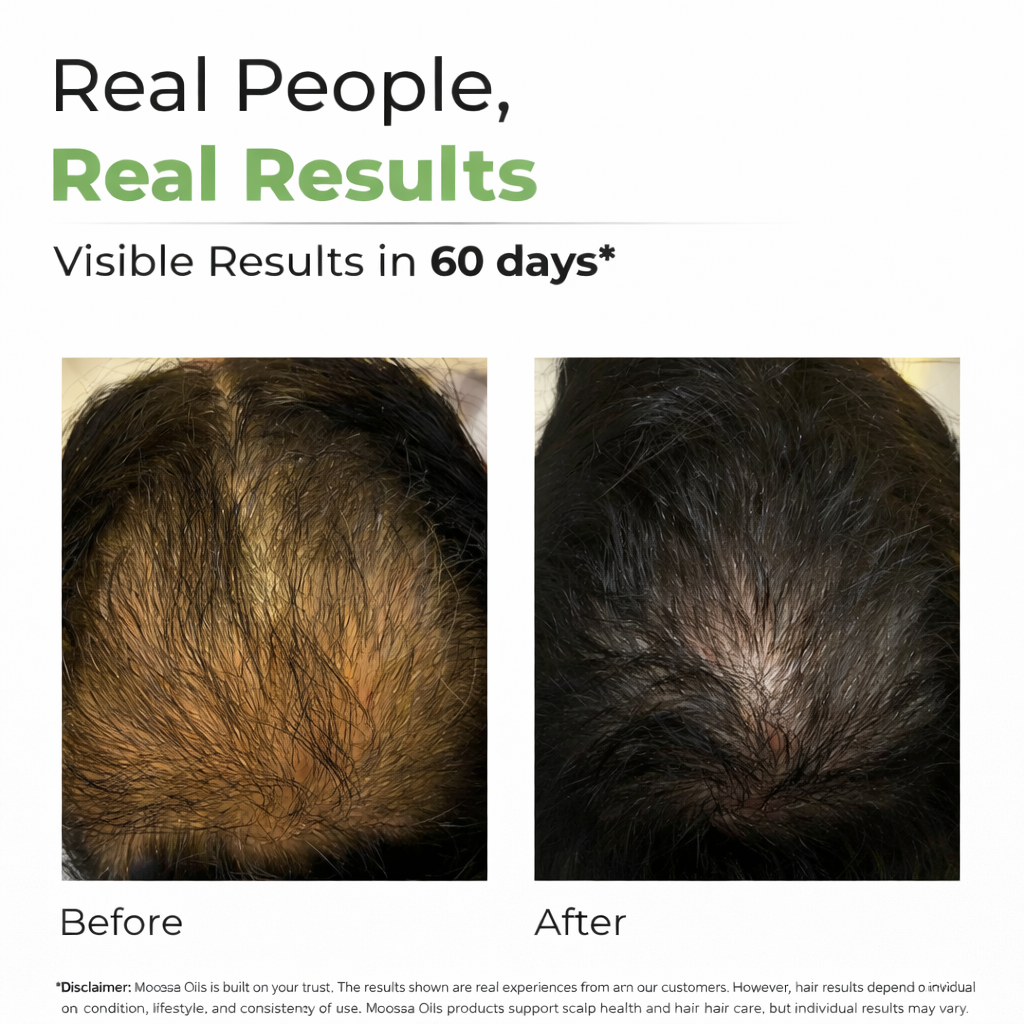 Hair Fall Control Oil