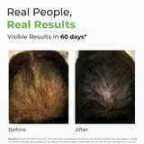 Hair Fall Control Oil
