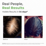 Hair Growth Oil